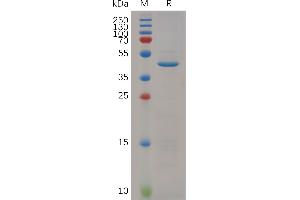 Mouse RN Protein, hFc Tag on SDS-PAGE under reducing condition. (RNASE4 Protein (AA 30-148) (Fc Tag))