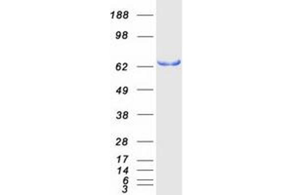 SH3BP2 Protein (Transcript Variant 1) (Myc-DYKDDDDK Tag)