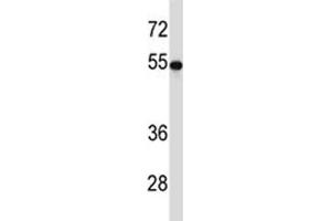 TUBB2A antibody western blot analysis in 293 lysate. (TUBB2A antibody  (AA 410-438))