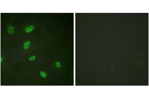 Immunofluorescence analysis of HeLa cells, using Histone H2B (Acetyl-Lys5) Antibody. (Histone H2B antibody  (acLys5))