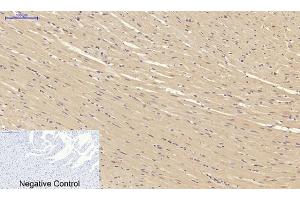 Immunohistochemical analysis of paraffin-embedded rat heart tissue. (SMAD2 antibody)