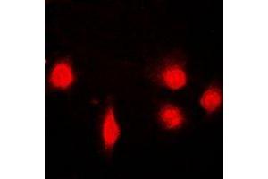 Immunofluorescent analysis of SH2B1 staining in U2OS cells. (SH2B1 antibody)