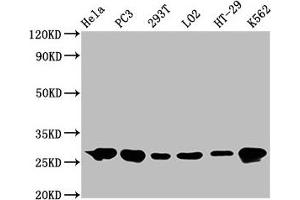 Western Blotting (WB) image for anti-Heat Shock 27kDa Protein 1 (HSPB1) antibody (ABIN7127557)