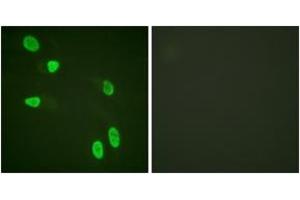 Immunofluorescence analysis of HeLa cells, using Histone H4 (Ab-8) Antibody. (Histone H4 antibody  (AA 6-55))