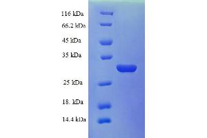 SDS-PAGE (SDS) image for Kallikrein B, Plasma (Fletcher Factor) 1 (KLKB1) (AA 391-638), (Light Chain) protein (His tag) (ABIN5709815) (KLKB1 Protein (AA 391-638, Light Chain) (His tag))