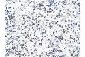 FECH antibody was used for immunohistochemistry at a concentration of 4-8 ug/ml to stain Hepatocytes (arrows) in Human Liver. (FECH antibody)