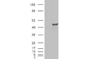 HEK293 overexpressing ESRRG and probed with ABIN2562479 (mock transfection in first lane). (ESRRG antibody  (Internal Region))