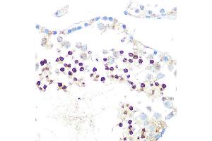 Immunohistochemistry of paraffin-embedded rat testis using HP1 alpha/CBX5Rabbit mAb (ABIN1678748, ABIN3018030, ABIN3018031 and ABIN7101571) at dilution of 1:100 (40x lens). (CBX5 antibody)