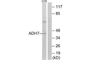 Western Blotting (WB) image for anti-Alcohol Dehydrogenase 7 (Class IV), mu Or sigma Polypeptide (ADH7) (Internal Region) antibody (ABIN1850712) (ADH7 antibody  (Internal Region))