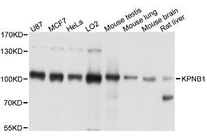 Western blot analysis of extracts of various cell lines, using KPNB1 antibody (ABIN5996286) at 1/1000 dilution. (KPNB1 antibody)