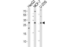 Western blot analysis of lysates from HepG2, MCF-7, U-2OS cell line (from left to right), using ID1 Antibody at 1:1000 at each lane. (ID1 antibody  (AA 66-93))