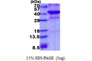 Image no. 1 for X-Ray Repair Complementing Defective Repair in Chinese Hamster Cells 3 (XRCC3) protein (His tag) (ABIN1098726) (XRCC3 Protein (His tag))