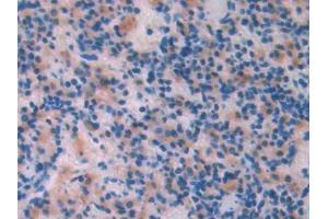 DAB staining on IHC-P; Samples: Rat Spleen Tissue (LCAT antibody  (AA 41-210))