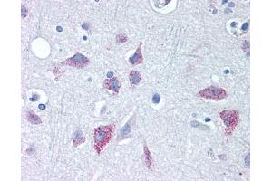 Immunohistochemistry (IHC) image for anti-Wingless-Type MMTV Integration Site Family, Member 8B (WNT8B) (Internal Region) antibody (ABIN2470571) (WNT8B antibody  (Internal Region))