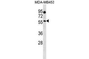 Western Blotting (WB) image for anti-beta-1,4-N-Acetyl-Galactosaminyl Transferase 1 (B4GALNT1) antibody (ABIN3000154) (B4GALNT1 antibody)