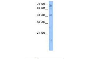 Image no. 1 for anti-Membrane Bound O-Acyltransferase Domain Containing 7 (MBOAT7) (AA 351-400) antibody (ABIN321686) (MBOAT7 antibody  (AA 351-400))