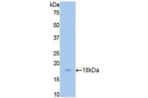 Detection of Recombinant CST3, Rat using Polyclonal Antibody to Cystatin C (Cys-C) (CST3 antibody  (AA 21-140))