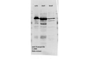 Image no. 1 for anti-Transportin 1 (TNPO1) antibody (ABIN341096) (Transportin 1 antibody)