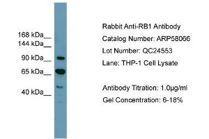 WB Suggested Anti-RB1  Antibody Titration: 0. (Retinoblastoma 1 antibody  (Middle Region))