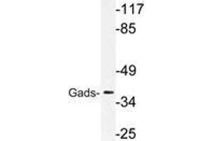 Western blot (WB) analysis of Gads antibody in extracts from HUVEC cells. (GRAP2 antibody)