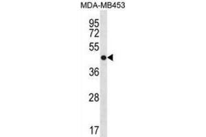 Western Blotting (WB) image for anti-Annexin A13 (ANXA13) antibody (ABIN3000989) (Annexin A13 antibody)