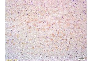 Immunohistochemistry (Paraffin-embedded Sections) (IHC (p)) image for anti-CD90 (THY1) (AA 31-120) antibody (ABIN728038)