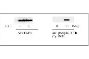 Western Blotting (WB) image for Epidermal Growth Factor Receptor (EGFR) ELISA Kit (ABIN1981829)