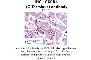 Image no. 1 for anti-Chemokine (C-X-C Motif) Receptor 4 (CXCR4) (C-Term) antibody (ABIN1733400) (CXCR4 antibody  (C-Term))