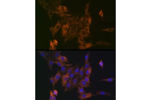Immunofluorescence analysis of NIH/3T3 cells using LPP Rabbit mAb (ABIN7268284) at dilution of 1:100 (40x lens). (LPP antibody)