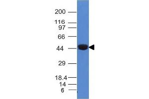 Western Blot Analysis of A431 cell lysate using Cytokeratin 8 Mouse Monoclonal Antibody (K8/383). (KRT8 antibody)