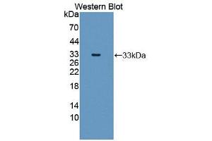 Western blot analysis of the recombinant protein. (MMP20 antibody  (AA 137-398))