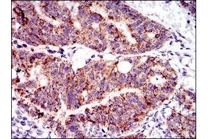 Immunohistochemistry (IHC) image for anti-Protein tyrosine Phosphatase, Non-Receptor Type 11 (PTPN11) (AA 263-329) antibody (ABIN1098117)