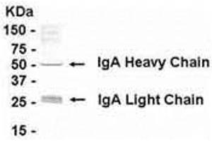 Western Blotting (WB) image for Chicken anti-Human IgA antibody (ABIN2469250)