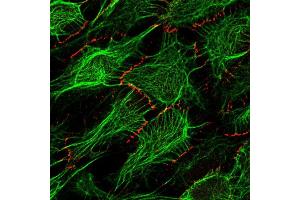 HaCaT PKP1 (red), cytokeratin (green) (courtesy of L. (Plakophilin 1 antibody)