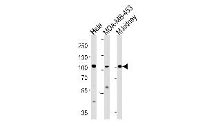 Western blot analysis in Hela,MDA-MB-453 cell line and mouse kidney tissue lysates (35ug/lane). (NCOA7 antibody  (N-Term))