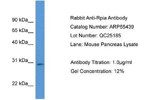 Western Blotting (WB) image for anti-Ribose 5-Phosphate Isomerase A (RPIA) (Middle Region) antibody (ABIN785748) (Ribose 5-Phosphate Isomerase A (RPIA) (Middle Region) antibody)