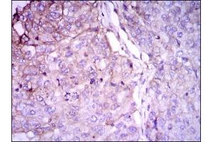 Immunohistochemistry (IHC) image for anti-RAB4A, Member RAS Oncogene Family (RAB4A) antibody (ABIN969558)