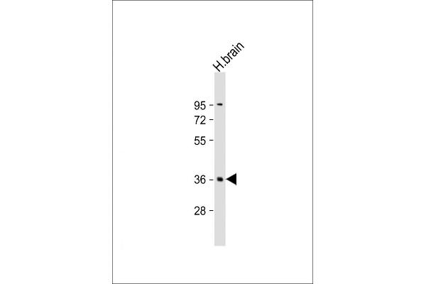 PLK5 antibody  (AA 140-174)