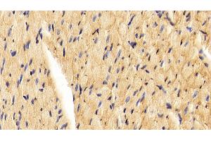 Detection of CAV1 in Rat Cardiac Muscle Tissue using Polyclonal Antibody to Caveolin 1 (CAV1) (Caveolin-1 antibody  (AA 2-105))