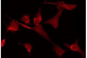 ABIN6275139 staining LOVO by IF/ICC. (GABRD antibody  (Internal Region))