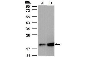 WB Image Sample(30 μg of whole cell lysate) A:A431, B:MOLT4, 12% SDS PAGE antibody diluted at 1:2000 (COX IV antibody  (Center))