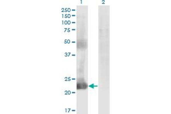 CCDC115 antibody  (AA 1-132)