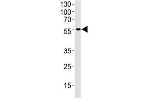 Western blot analysis of human brain tissue lysate using DCX antibody at 1:1000. (Doublecortin antibody  (AA 107-137))