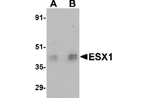 Western Blotting (WB) image for anti-ESX Homeobox 1 (ESX1) (Middle Region) antibody (ABIN1030926) (ESX Homeobox 1 antibody  (Middle Region))