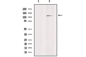 Western blot analysis of extracts from HepG2, using RANBP17 Antibody. (RANBP17 antibody  (N-Term))