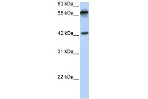 MICA antibody used at 1 ug/ml to detect target protein. (MICA antibody  (N-Term))