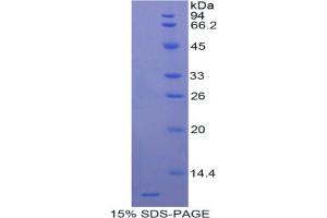 SDS-PAGE analysis of Rat Apolipoprotein C3 Protein. (APOC3 Protein)