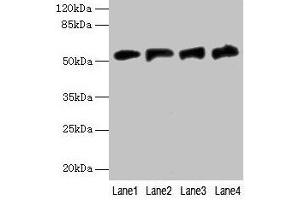Western blot All lanes: FDXR antibody at 6 μg/mL Lane 1: A549 whole cell lysate Lane 2: Mouse liver tissue Lane 3: HepG2 whole cell lysate Lane 4: U251 whole cell lysate Secondary Goat polyclonal to rabbit IgG at 1/10000 dilution Predicted band size: 54, 55, 59, 49, 53, 50, 58 kDa Observed band size: 54 kDa (Ferredoxin Reductase antibody  (AA 33-451))