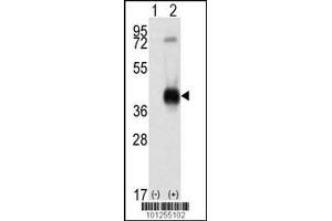 Western blot analysis of CAMK1 using rabbit polyclonal CAMK1 Antibody using 293 cell lysates (2 ug/lane) either nontransfected (Lane 1) or transiently transfected with the CAMK1 gene (Lane 2). (CAMK1 antibody  (C-Term))