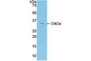 Western blot analysis of recombinant Human RORg. (RORC antibody  (AA 212-461))